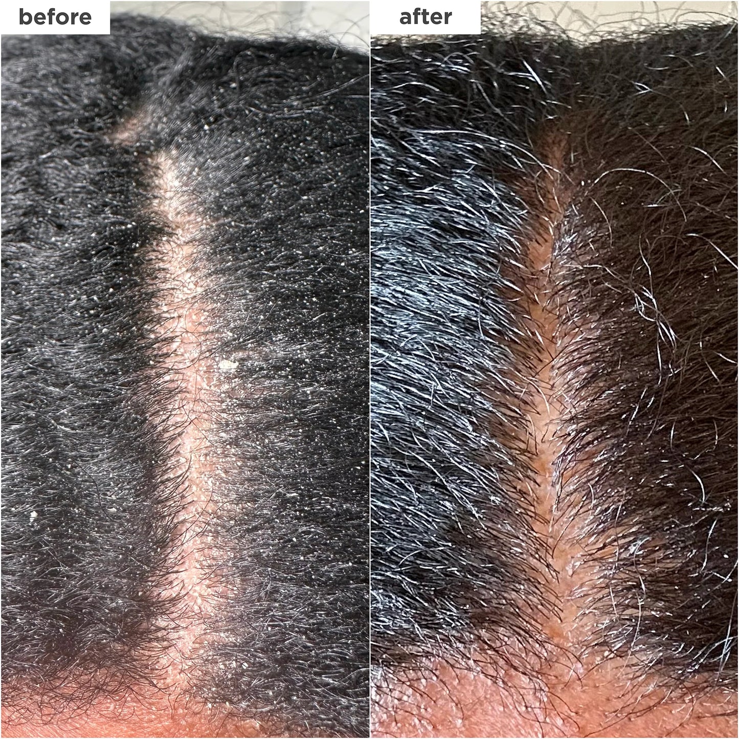 Briogeo Scalp Revival MegaStrength + Dandruff Relief Shampoo