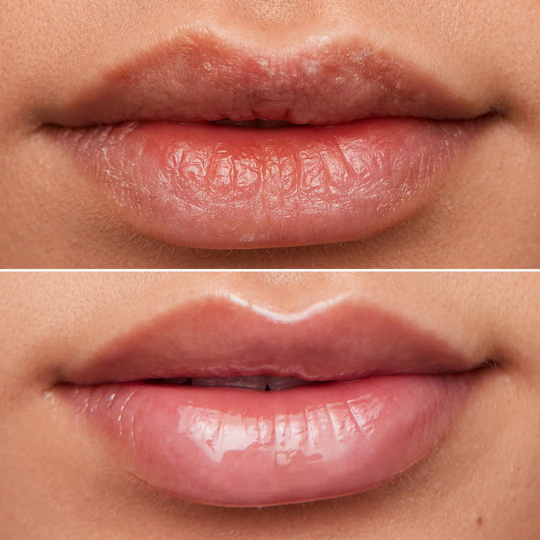 WONDERSKIN Lip Rehab Oil Serum - Clear