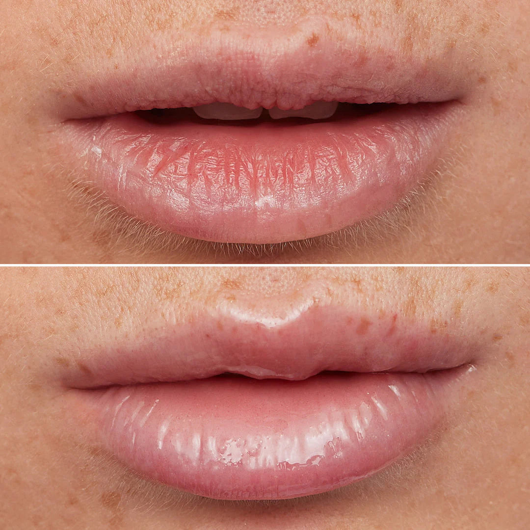 WONDERSKIN Lip Rehab Oil Serum - Clear